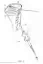 Fig. 04 - Retrograde resection apparatus and method