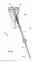 Fig. 10 - Retrograde resection apparatus and method