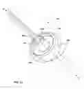 Fig. 13 - Retrograde resection apparatus and method
