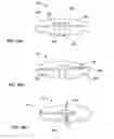 Fig. 18 - Retrograde resection apparatus and method