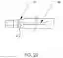 Fig. 20 - Tissue retrieval system