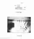 Fig. 04 - Method and apparatus for grafting of skin tissue