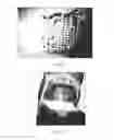Fig. 05 - Method and apparatus for grafting of skin tissue