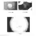 Fig. 06 - Method and apparatus for grafting of skin tissue