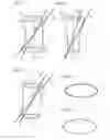 Fig. 05 - APPARATUS FOR PROVIDING AND MAINTAINING ACCESS TO A SURGICAL SITE