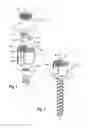 Fig. 02 - Polyaxial bone anchoring device