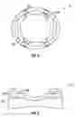 Fig. 04 - Orthopedic fixation devices and methods of installation thereof