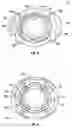 Fig. 06 - Orthopedic fixation devices and methods of installation thereof