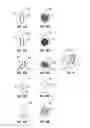Fig. 07 - IMPLANT AND METHOD FOR FACET IMMOBILIZATION