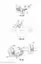 Fig. 09 - IMPLANT AND METHOD FOR FACET IMMOBILIZATION