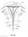 Fig. 09 - GYNECOLOGICAL TREATMENT METHODS