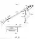 Fig. 16 - GYNECOLOGICAL TREATMENT METHODS