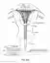 Fig. 28 - GYNECOLOGICAL TREATMENT METHODS