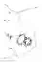 Fig. 15 - Pulmonary vein isolation gap finder