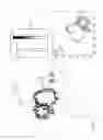 Fig. 17 - Pulmonary vein isolation gap finder