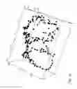 Fig. 18 - Pulmonary vein isolation gap finder