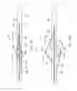Fig. 09 - Low profile catheter assemblies and associated systems and methods