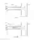 Fig. 10 - Low profile catheter assemblies and associated systems and methods