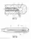 Fig. 03 - Apparatus and methods for side-fire optical fiber device suitable for medical applicatons