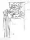 Fig. 01 - Patient specific implantation method for range of motion hip impingement
