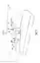 Fig. 20 - Patient specific implantation method for range of motion hip impingement
