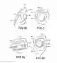 Fig. 05 - Method for producing a customized orthodontic appliance