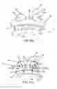 Fig. 07 - Method for producing a customized orthodontic appliance