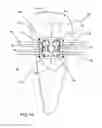 Fig. 10 - Method for producing a customized orthodontic appliance