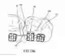 Fig. 12 - Method for producing a customized orthodontic appliance