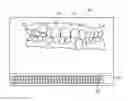 Fig. 01 - Orthodontic digital setups