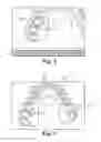 Fig. 05 - Orthodontic digital setups
