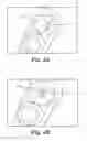 Fig. 06 - Orthodontic digital setups