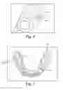 Fig. 07 - Orthodontic digital setups