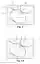 Fig. 08 - Orthodontic digital setups
