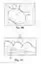 Fig. 09 - Orthodontic digital setups