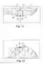 Fig. 13 - Orthodontic digital setups