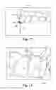 Fig. 14 - Orthodontic digital setups