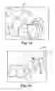 Fig. 15 - Orthodontic digital setups