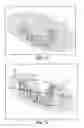 Fig. 16 - Orthodontic digital setups
