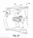 Fig. 43 - Orthodontic digital setups