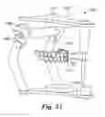 Fig. 44 - Orthodontic digital setups