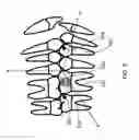 Fig. 07 - ORTHODONTIC SYSTEMS