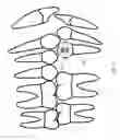 Fig. 04 - Orthodontic systems