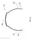Fig. 10 - Orthodontic systems