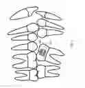 Fig. 04 - Orthodontic systems