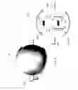 Fig. 05 - Orthodontic systems