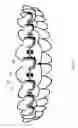 Fig. 11 - Orthodontic systems