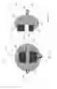 Fig. 04 - Orthodontic systems