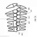 Fig. 12 - Orthodontic systems