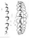 Fig. 22 - Orthodontic systems